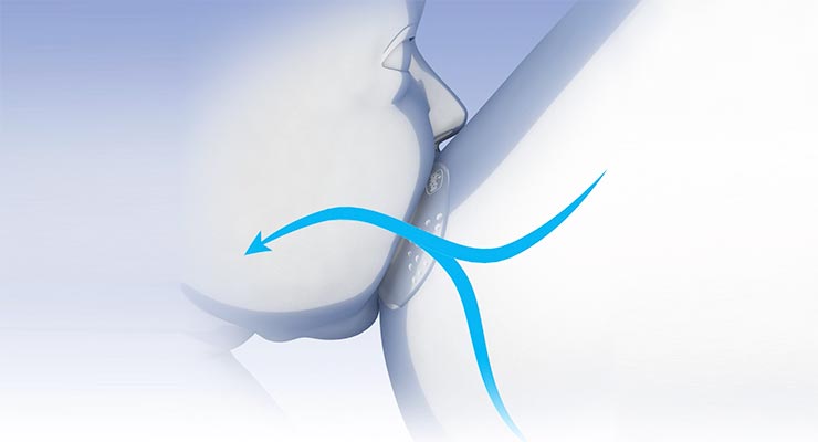 Chicco aparatoare de san din silicon 2 buc/set marimea M/L 02