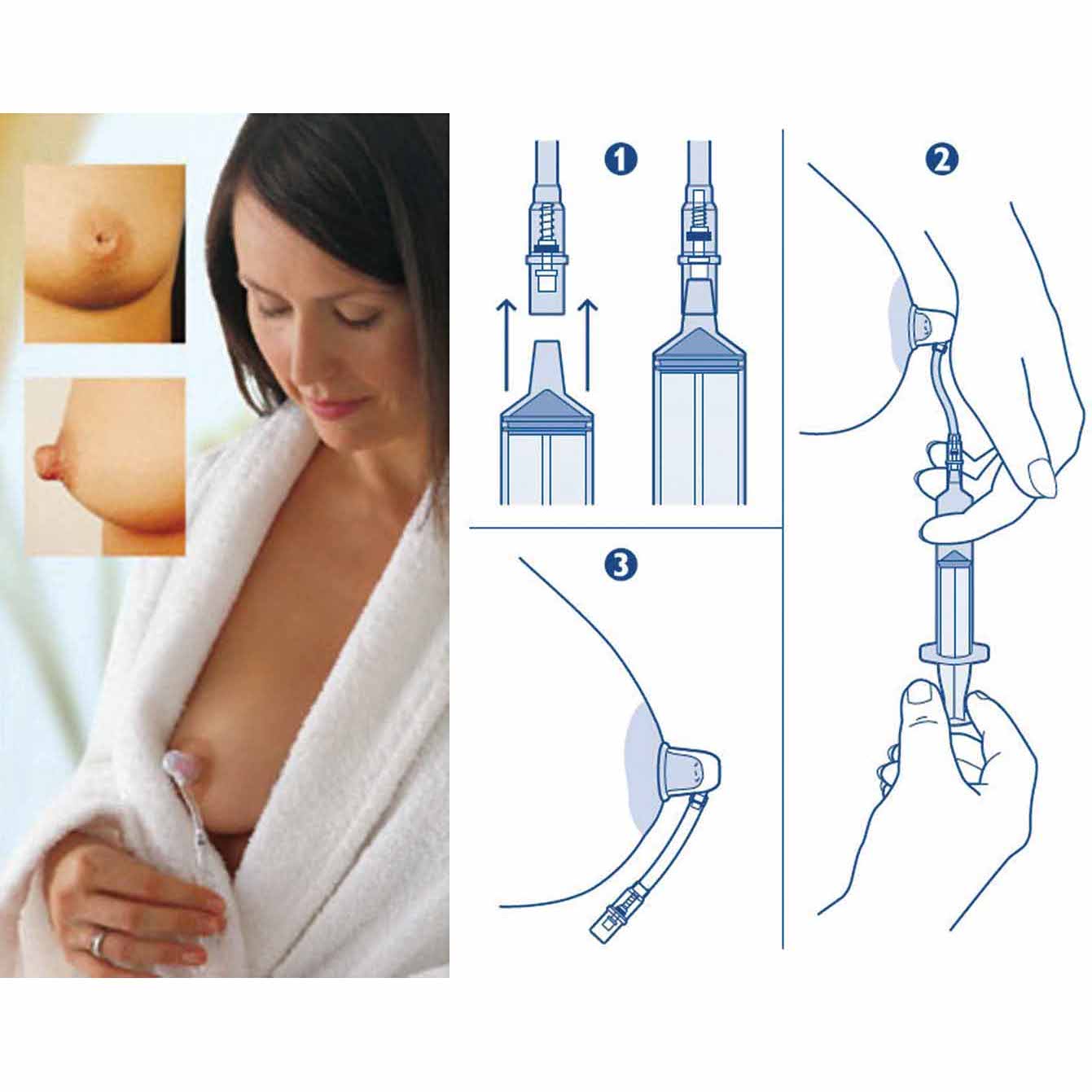 Philips Avent Corector pentru mamelon Niplette 04